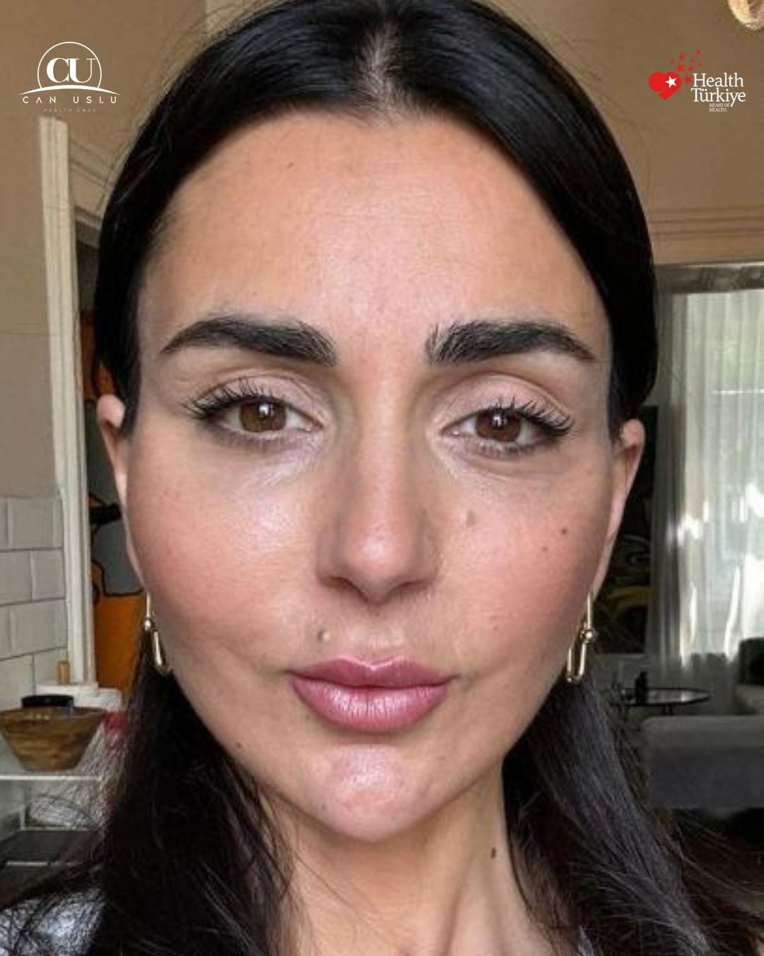 Sonrası
